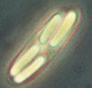 Metabacterium with four daughter spores