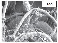 Higher resolution image, showing the segmented filamentous bacteria.